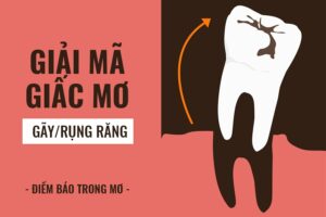 rụng răng 