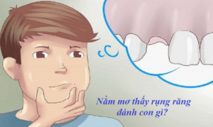 rụng răng 